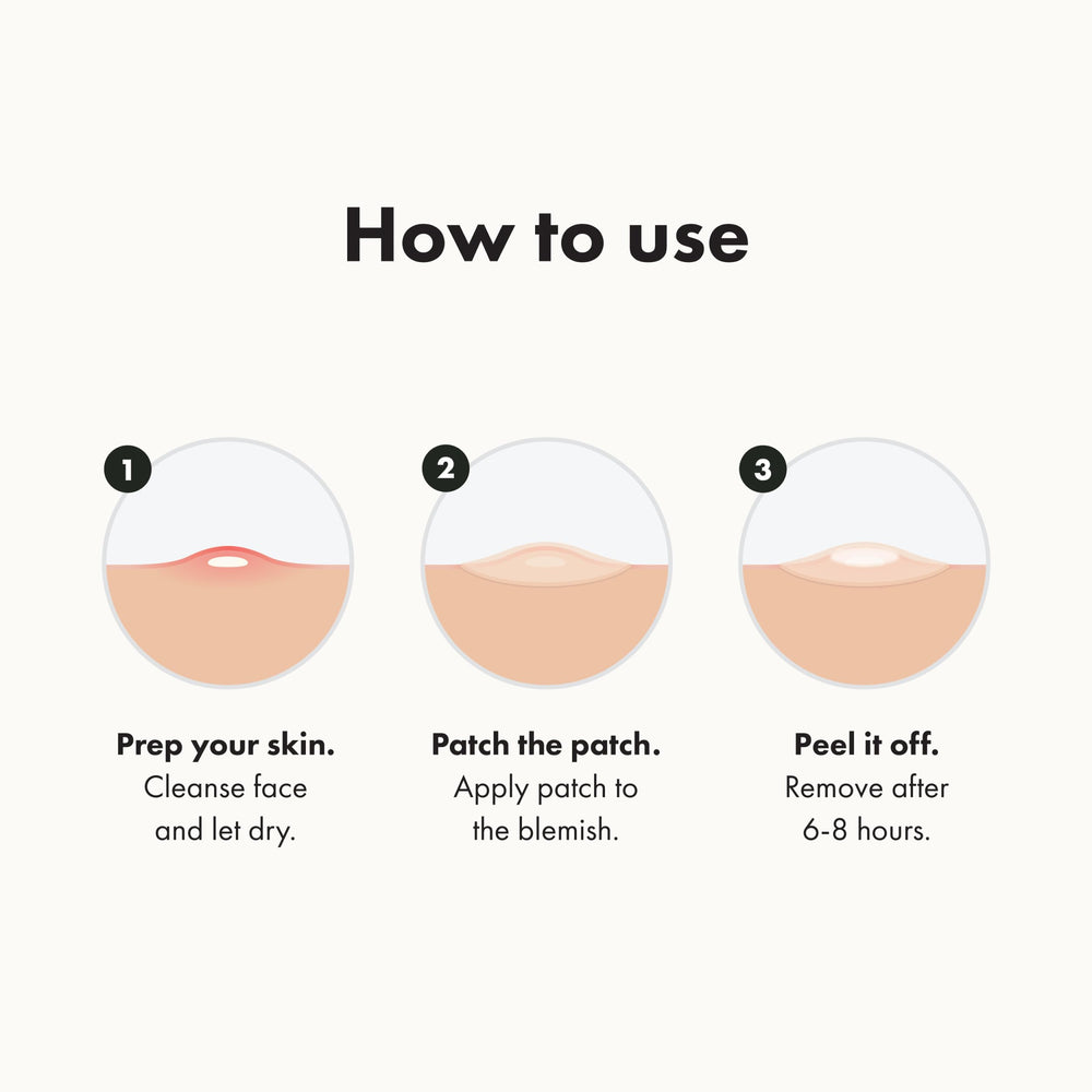 Original Patch from Hero Cosmetics - #1 Hydrocolloid Acne Pimple Patches for Face, Shrinking Zits & Whiteheads in 1 Use, Nighttime Spot Pimple Stickers for Face, 36 Count